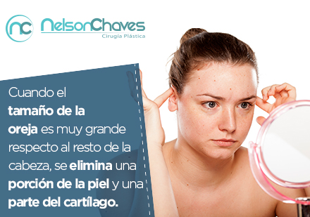 La otoplastia es la solución para reducción de orejas con un cirujano plástico en Bogotá Mujer con orejas grandes que necesita una otoplastia