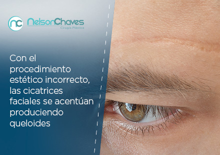 Correccin de Cicatriz Facial con Ciruga Plstica en Colombia