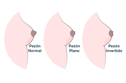Diferencias entre pezn normal, plano e invertido con un cirujano plstico en Bogot 