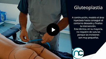 Gluteoplastia