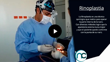 Rinoplastia Rinoplastia