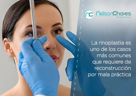 Siempre Verifica que tu Cirujano Plástico en Colombia esté Certificado Cirujano Plástico en Colombia Examinando Nariz