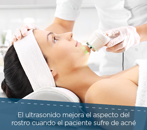 El Ultrasonido es Beneficioso para las Pieles con Problemas de Acné Mujer Recibiendo Ultrasonido Facial