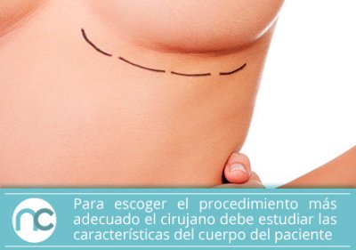 Escoge el médico cirujano adecuado Escoge el médico cirujano adecuado