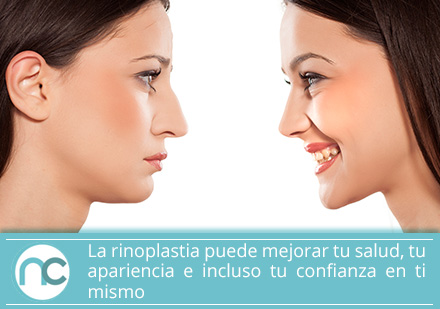 Un cirujano plástico de rinoplastia puede ayudarte a mejorar tu apariencia Un cirujano plástico de rinoplastia puede ayudarte a mejorar tu apariencia