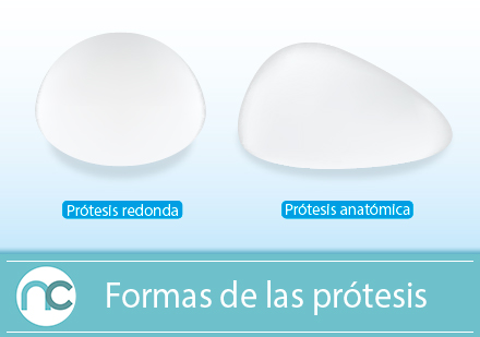 Te ayudamos a elegir las prótesis mamarias para tu próxima cirugía de senos Formas de prótesis mamarias para una cirugía de senos