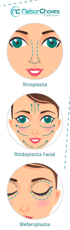 Cirugía Plástica Facial - Conoce Nuestras Intervenciones Quirúrgicas