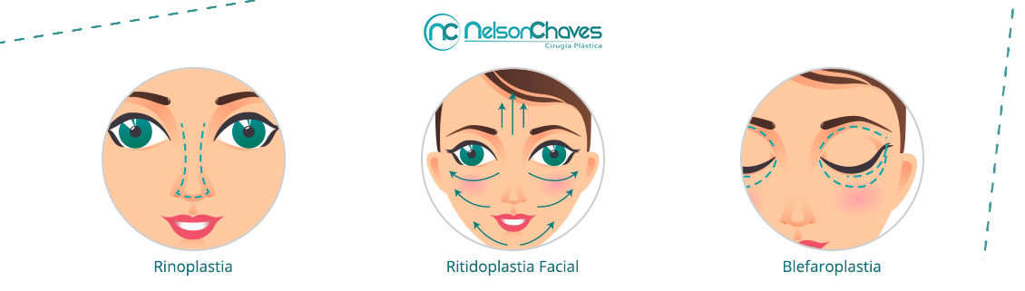 Cirugía Plástica Facial
