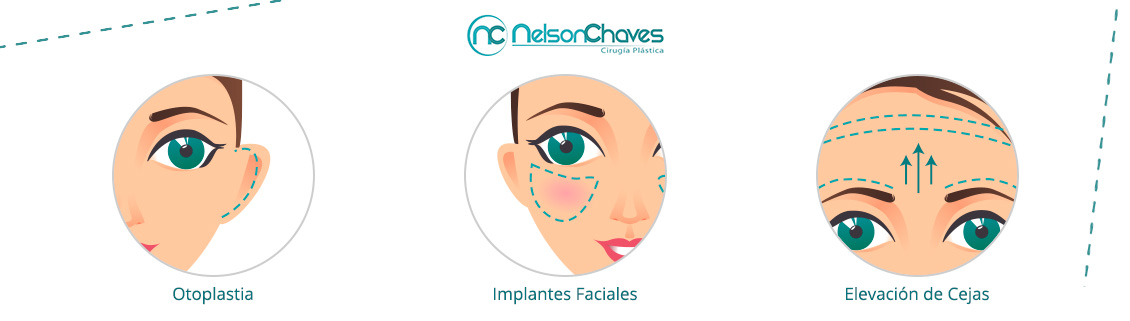 Cirugía Plástica Facial en Bogotá
