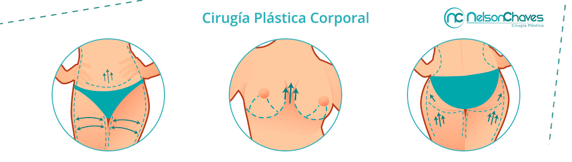 Existen Diferentes Cirugías Plásticas Corporales para Mejorar tu Silueta, ¡Conócelas! Cirugía Plástica Corporal