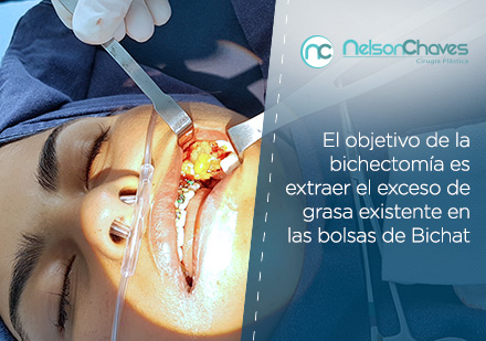 Antes de tu Cirugía Plástica en Colombia Asesórate con un Cirujano de Confianza Cirugía Plástica en Colombia en las Bolas de Bichat de una Mujer