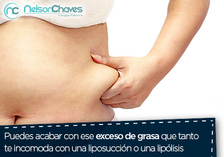 Mujer midiendo con sus manos su grasa abdominal