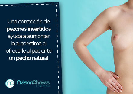 Este problema estético se puede solucionar con un cirujano plástico en Bogotá Paciente tras corrección de pezones por cirujano plástico en Bogotá