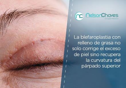 Conoce los Beneficios de la Blefaroplastia Consultando tu Cirujano Plástico en Colombia Cirujano plástico en Colombia líneas de blefaroplastia