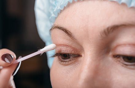 Limpieza de una Blefaroplastia en Bogot 