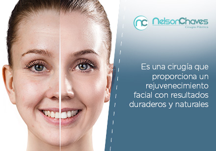 La Liposucción en Bogotá Junto a una Lipoinyección Facial Proveen Resultados Duraderos Relleno de Arrugas con Liposucción en Bogotá