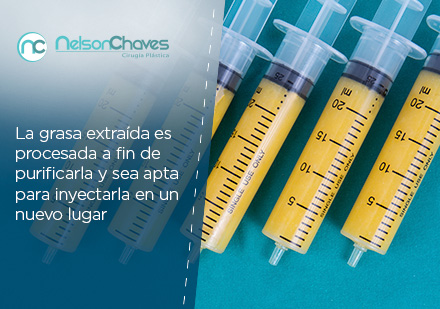 La Liposucción en Bogotá se Ha Convertido en un Procedimiento muy Popular Grasa Extraída por Liposucción en Bogotá