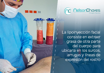 La Liposucción en Bogotá Puede Beneficiar el Contorno de tu Rostro Liposucción en Bogotá por Cirujano Plástico