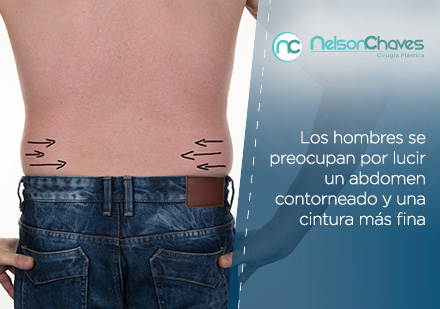 ¡Consigue el Contorno que Deseas con una Liposucción en Bogotá! Grasa Abdominal de un Hombre que Necesita una Lipoescultura