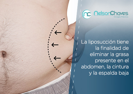 La lipoescultura es una de las Cirugías Plásticas en Colombia más Solicitadas Abdomen de un Hombre que Necesita una Cirugía Plástica en Colombia