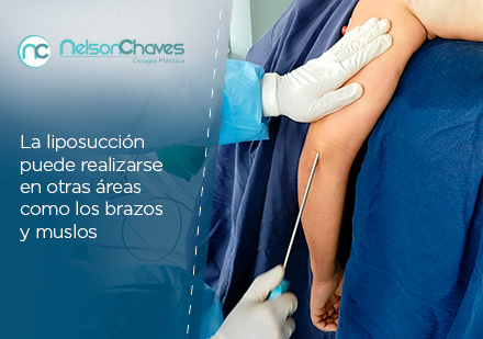 Entre las Cirugías Plásticas en Colombia más Demandadas por los Hombre está la Liposucción Silueta del Abdomen de un Hombre Previo a una Cirugía Plástica en Colombia