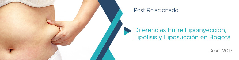Conoce más Sobre las Diferencias Entre Lipoinyección, Lipólisis y Liposucción en Bogotá Publicación Relacionada a Liposucción en Bogotá