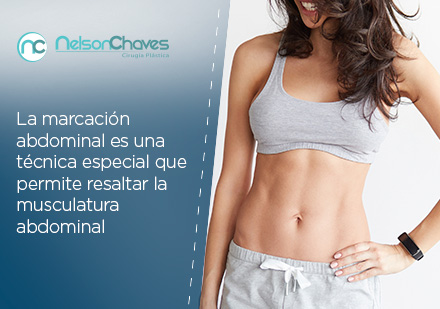 Conoce Como Marcar el Abdomen con una Cirugia Plastica