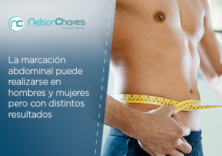 Hombre con Abdomen Marcado Gracias a una Liposuccin en Bogot