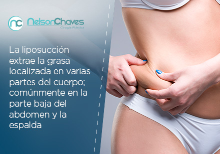 Mujer Agarrndose su Piel Grasa del Abdomen