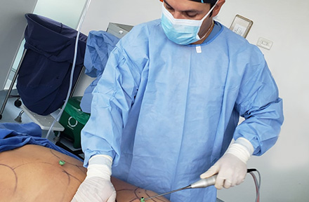 La Lipólisis con Lipoinyección es la Opción Ideal para Mejorar las Partes de tu Cuerpo que te Acomplejan Doctor Nelson Chaves Realizando una Lipólisis y aumento de Glúteos con Lipoinyección