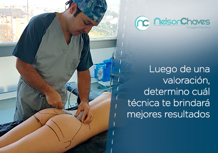Ambas Técnicas para Aumento de Glúteos Finalizan con Resultados Naturales Doctor Nelson Chaves Realizando una Cirugía de Aumento de Glúteos