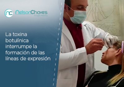 Rejuvenecimiento Facial Inyección Botulínica con Doctor Nelson Chaves 