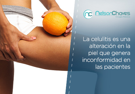  Mujer Desea Liposuccin Para Eliminar Exceso de Grasa en Abdomen y Celulitis