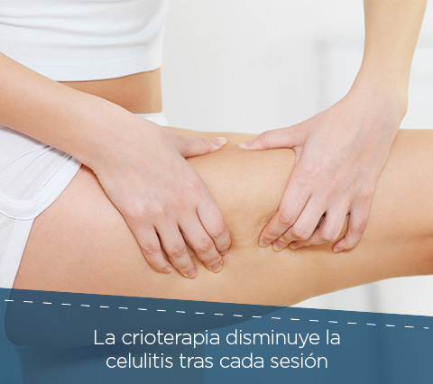 La Crioterapia Ayuda a Reducir la Celulitis Piernas con Celulitis