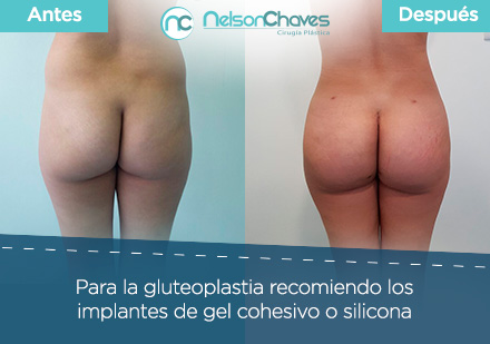 Antes y Después de una Gluteoplastia por un Cirujano Plástico en Colombia