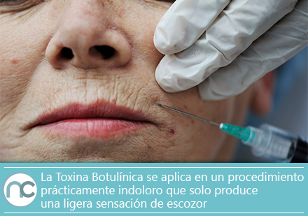 Mujer mayor aplicándose Toxina Botulínica por un cirujano plástico en Bogotá
