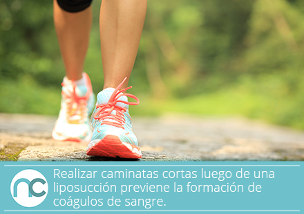 Debes seguir las recomendaciones de recuperación luego de una liposucción en Bogotá. Mujer caminando después de una liposucción en Bogotá