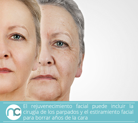 Mujer en antes y después de un rejuvenecimiento facial 