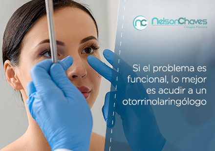 Rinoplastia Atendida por Otorrinolaringlogo